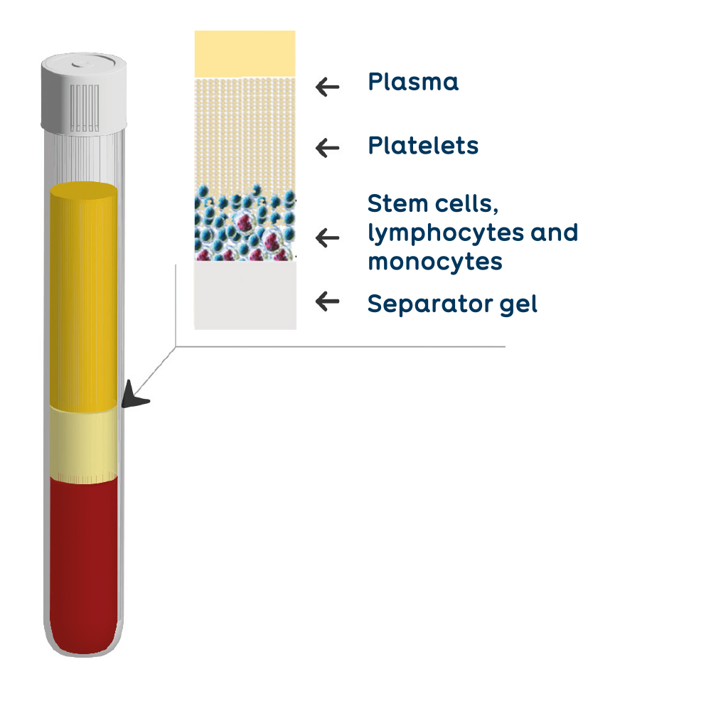 plasma composition