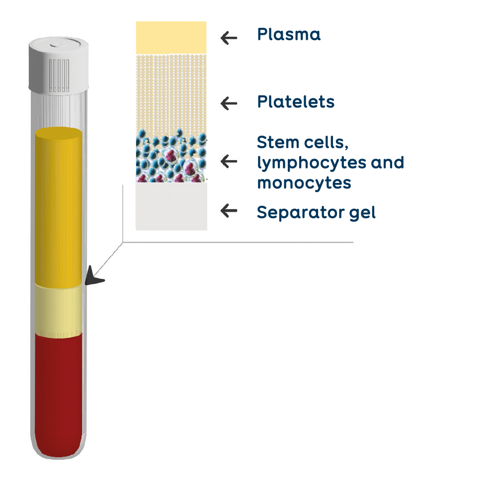 plasma composition